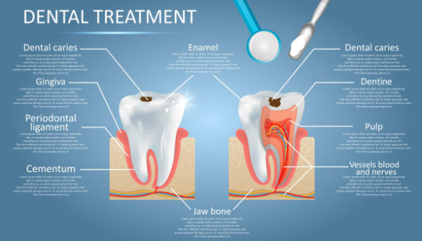Polokwane Dentist, CHILDRENS DENTISTRY, INLAYS & ONLAYS